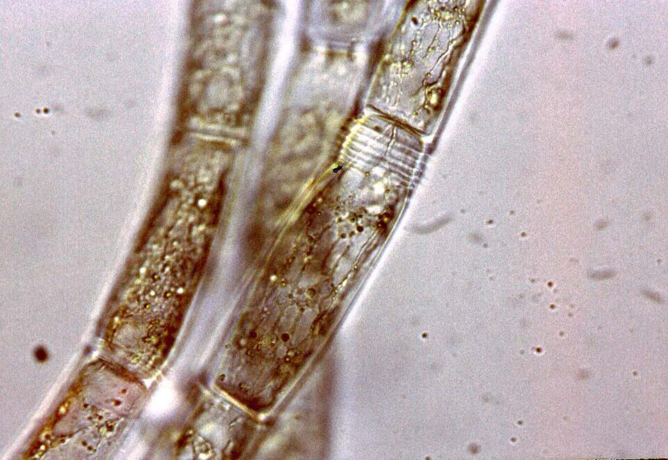 Oedogonium ao microscópio